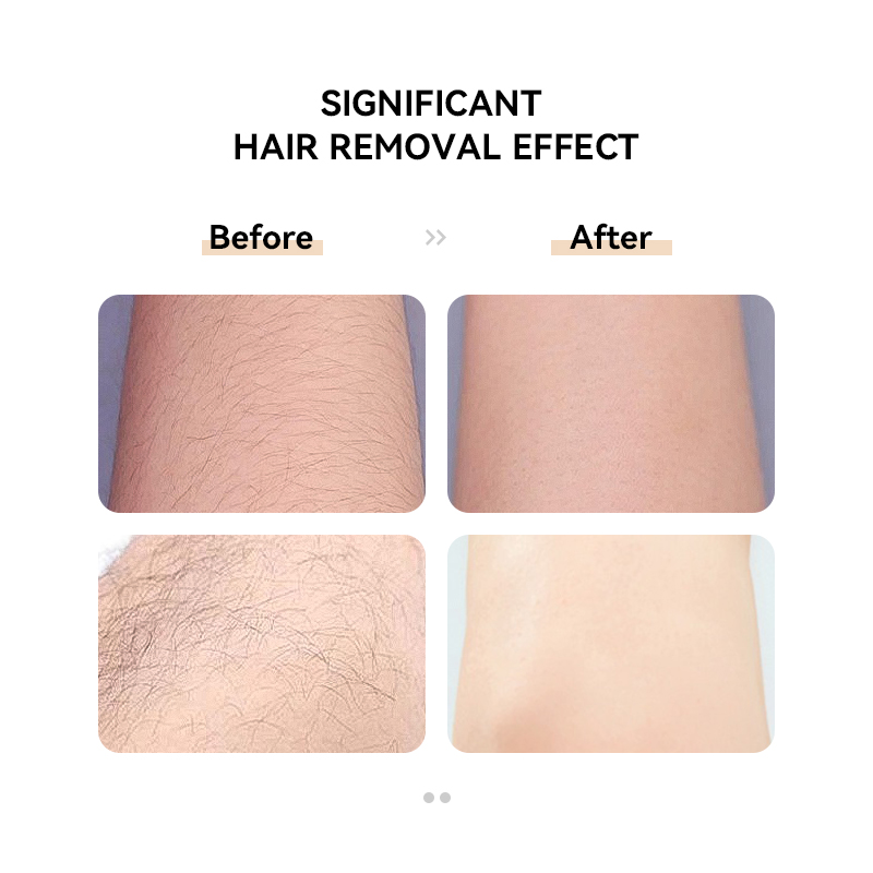 Crystal Hair Removal (5).jpg